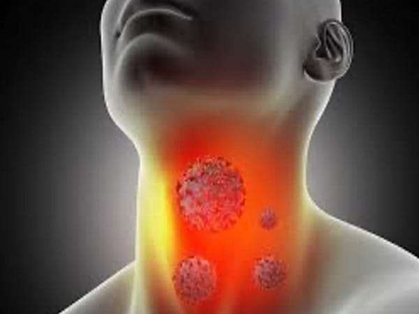 Nằm mơ thấy mình phát hiện ung thư ở giai đoạn sớm